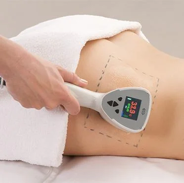 Skin tightening2 1