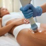 Cellulite treatment wilmslow