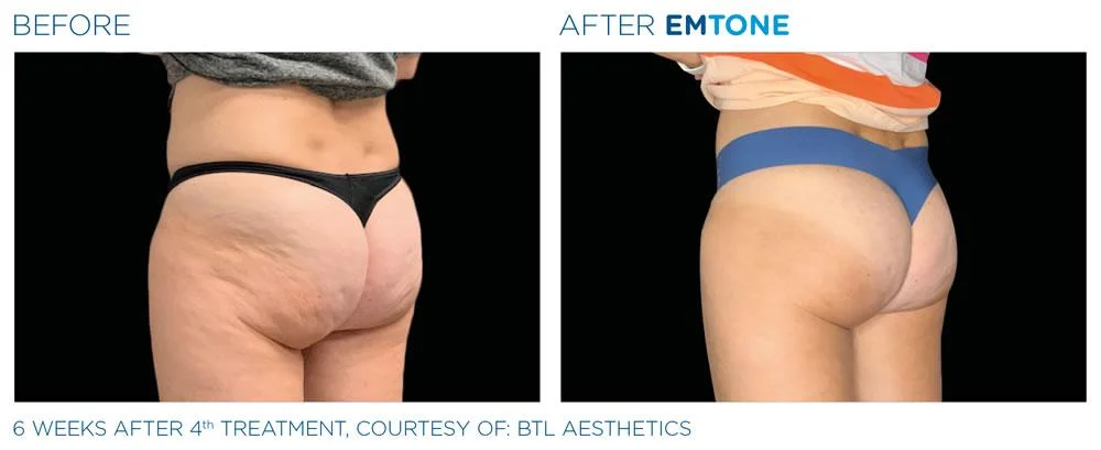 Emtone PIC Ba card female buttock 014 EN100 websize