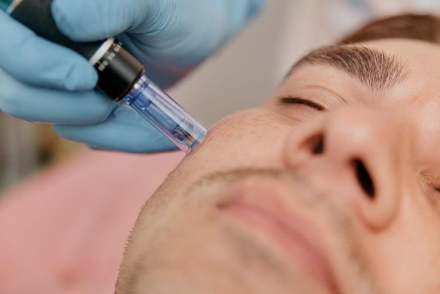 Medical Microneedling